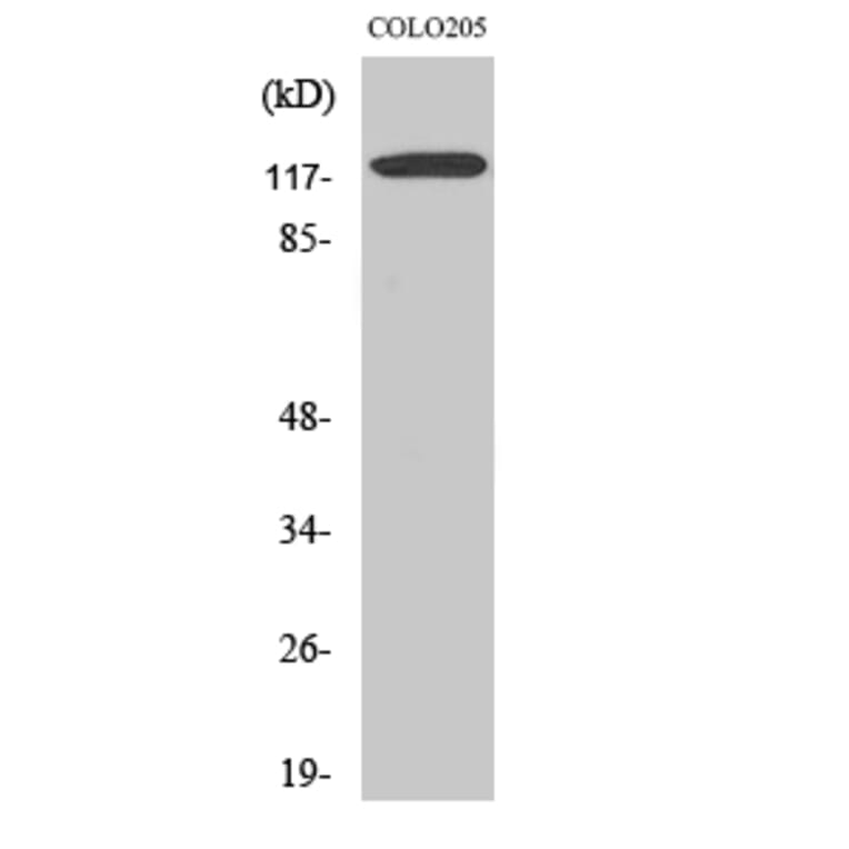 Western Blot - Anti-Ob-R Antibody (R12-2280) - Antibodies.com