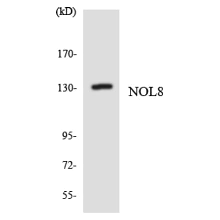 Western Blot - Anti-NOL8 Antibody (R12-3098) - Antibodies.com