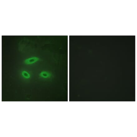 Immunofluorescence - Anti-NKTR Antibody (C10518) - Antibodies.com