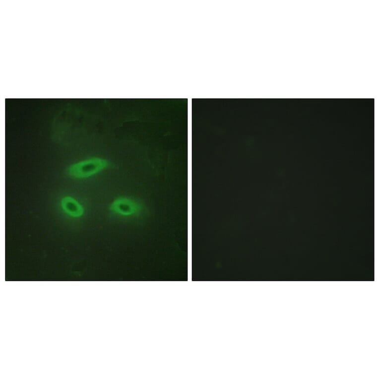 Immunofluorescence - Anti-NKTR Antibody (C10518) - Antibodies.com