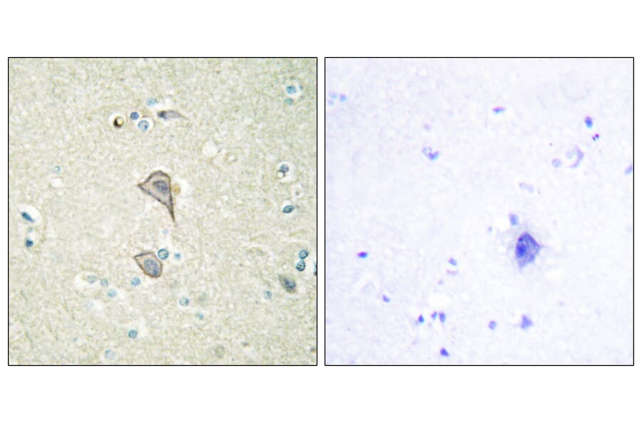 Immunohistochemistry - Anti-NKTR Antibody (C10518) - Antibodies.com