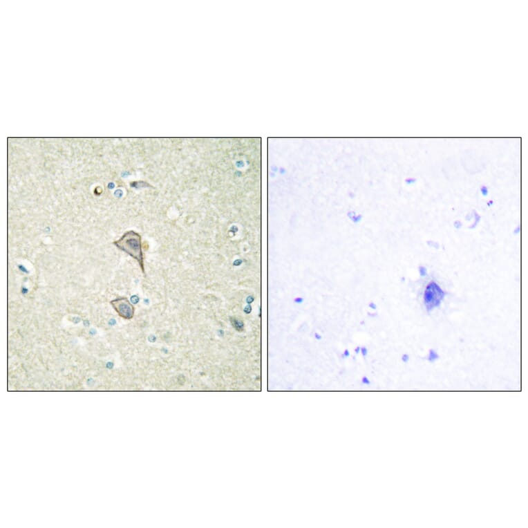 Immunohistochemistry - Anti-NKTR Antibody (C10518) - Antibodies.com