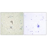 Immunohistochemistry - Anti-NKTR Antibody (C10518) - Antibodies.com
