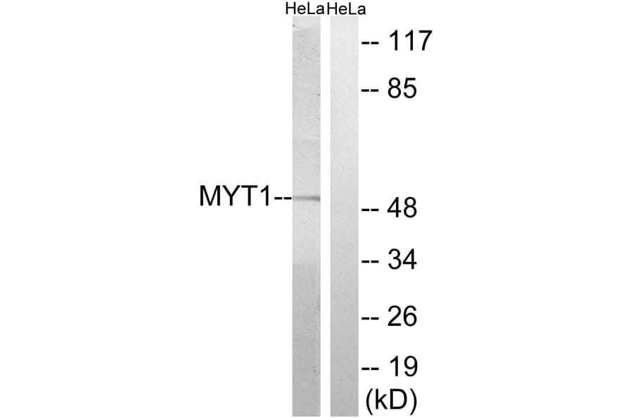 Western Blot - Anti-MYT1 Antibody (B8151) - Antibodies.com
