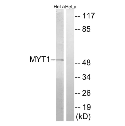 Western Blot - Anti-MYT1 Antibody (B8151) - Antibodies.com