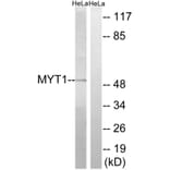 Western Blot - Anti-MYT1 Antibody (B8151) - Antibodies.com
