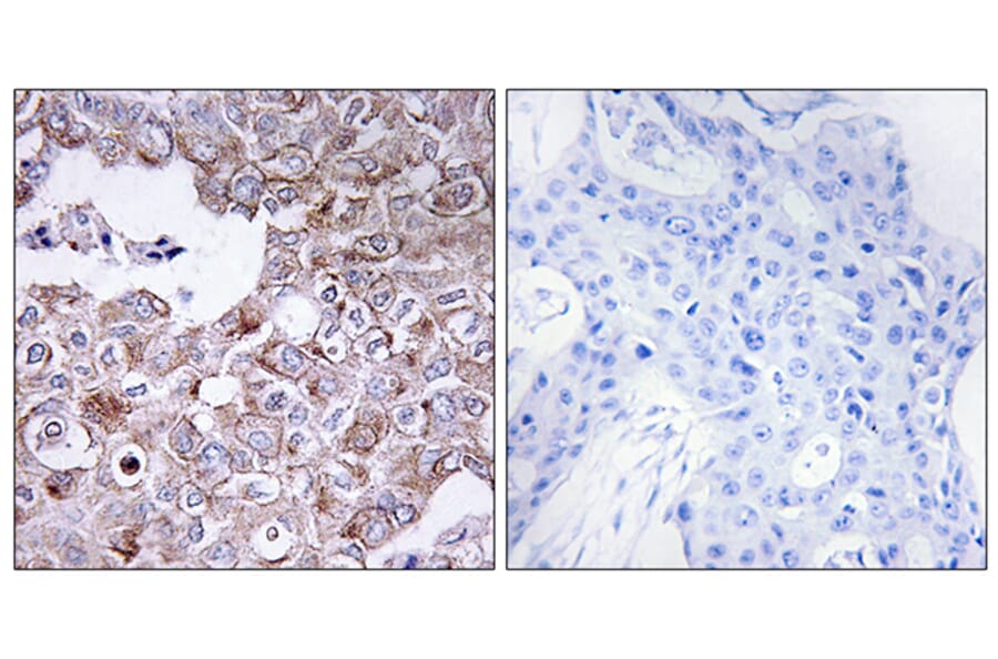 Immunohistochemistry - Anti-MUC1 Antibody (C10386) - Antibodies.com