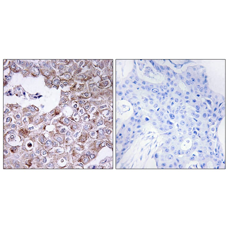Immunohistochemistry - Anti-MUC1 Antibody (C10386) - Antibodies.com