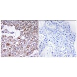 Immunohistochemistry - Anti-MUC1 Antibody (C10386) - Antibodies.com