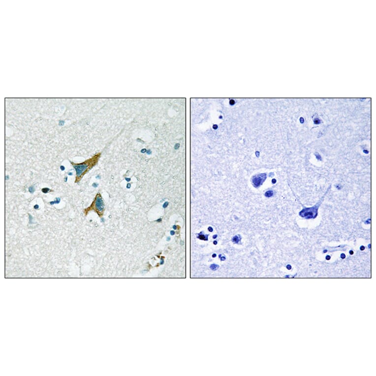 Immunohistochemistry - Anti-MKP1 Antibody (B1099) - Antibodies.com