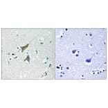 Immunohistochemistry - Anti-MKP1 Antibody (B1099) - Antibodies.com