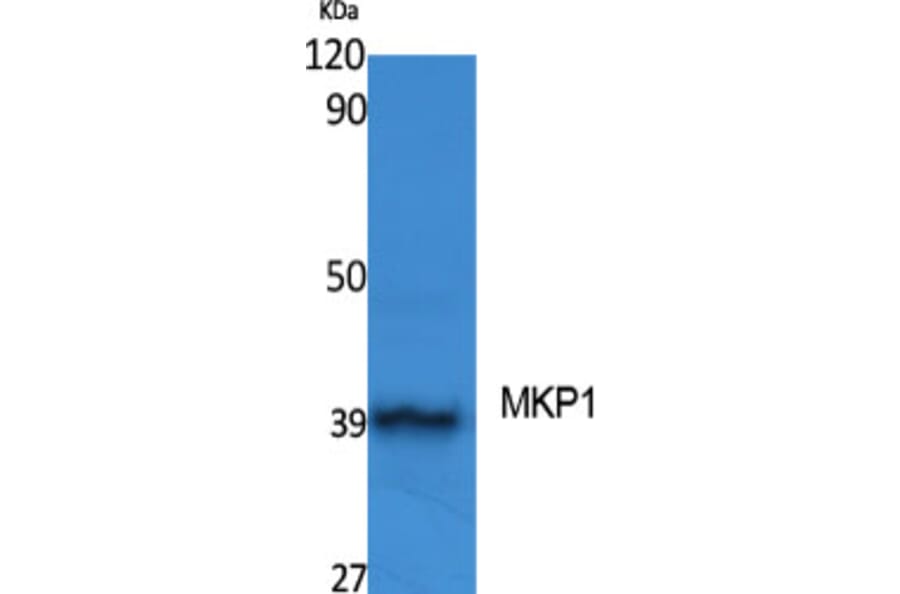 Western Blot - Anti-MKP1 Antibody (B1099) - Antibodies.com