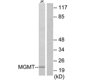 Western Blot - Anti-MGMT Antibody (C13084) - Antibodies.com