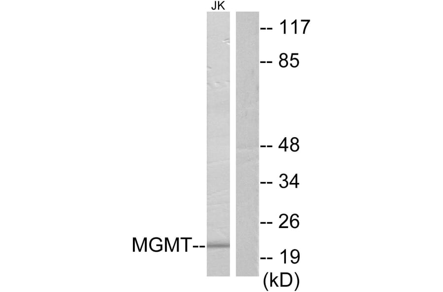 Western Blot - Anti-MGMT Antibody (C13084) - Antibodies.com