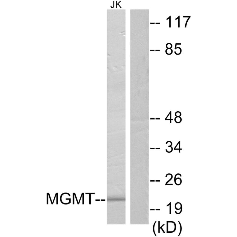Western Blot - Anti-MGMT Antibody (C13084) - Antibodies.com