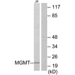 Western Blot - Anti-MGMT Antibody (C13084) - Antibodies.com