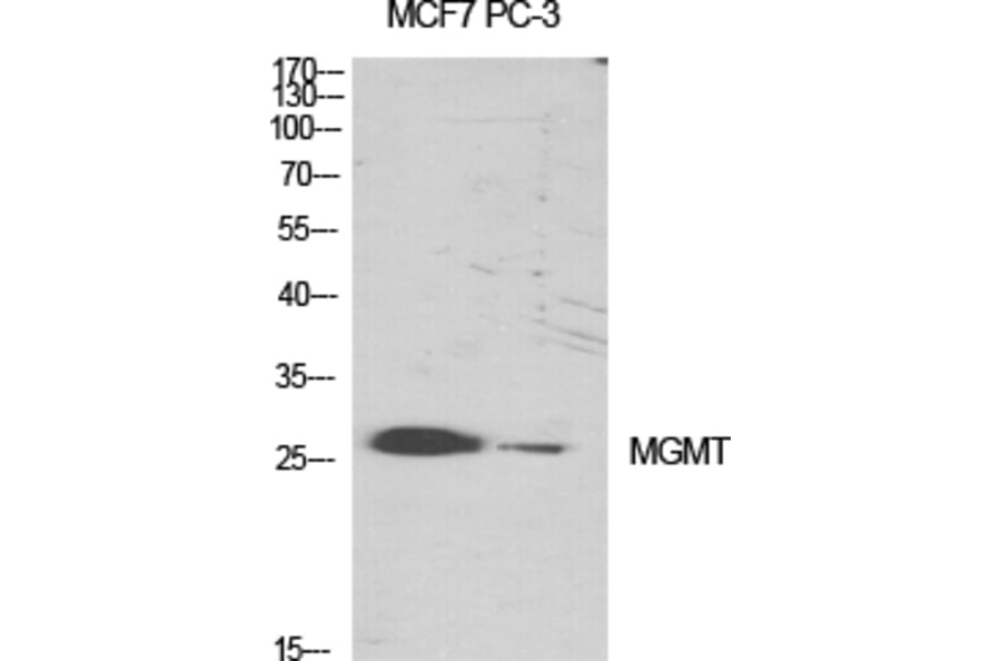 Western Blot - Anti-MGMT Antibody (C13084) - Antibodies.com