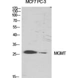 Western Blot - Anti-MGMT Antibody (C13084) - Antibodies.com