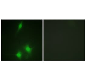 Immunofluorescence - Anti-MDM2 Antibody (B1154) - Antibodies.com