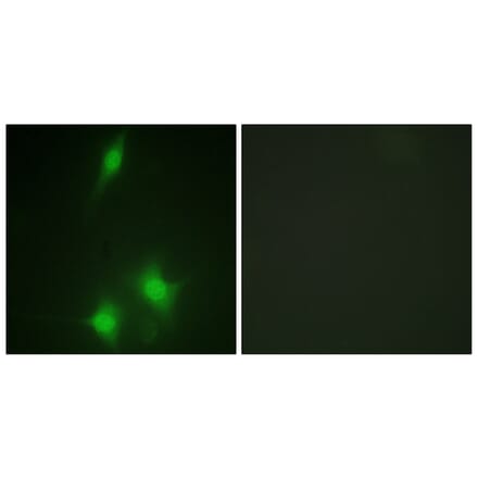 Immunofluorescence - Anti-MDM2 Antibody (B1154) - Antibodies.com