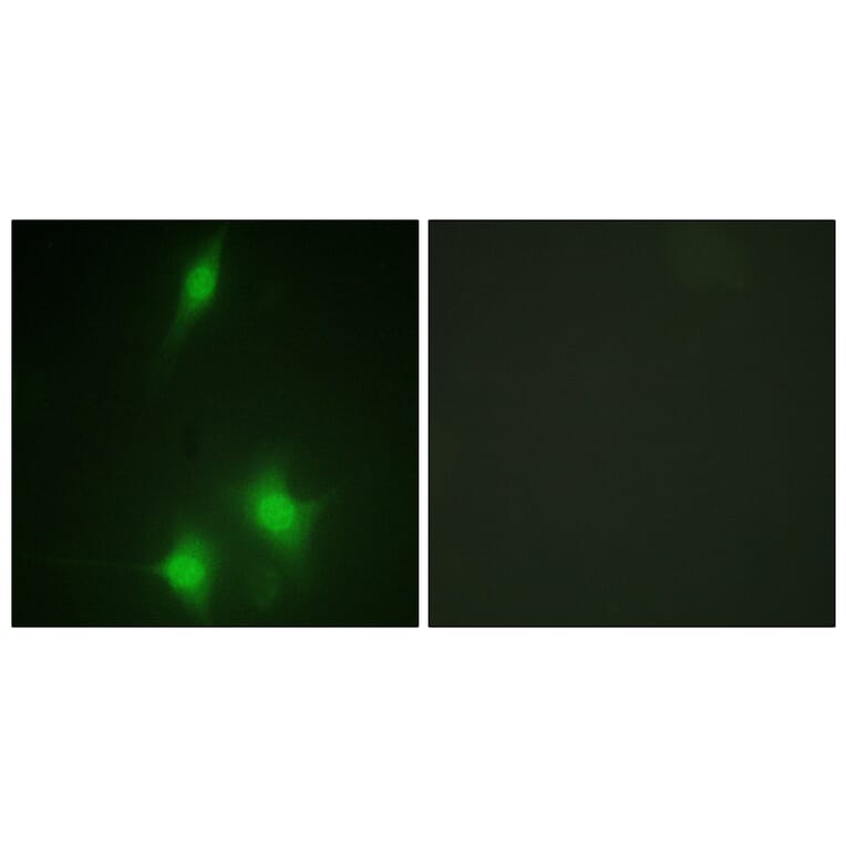 Immunofluorescence - Anti-MDM2 Antibody (B1154) - Antibodies.com
