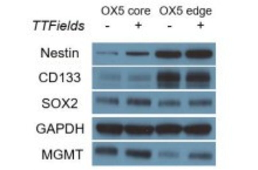 Western Blot - Anti-MDM2 Antibody - Antibodies.com