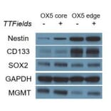 Western Blot - Anti-MDM2 Antibody - Antibodies.com