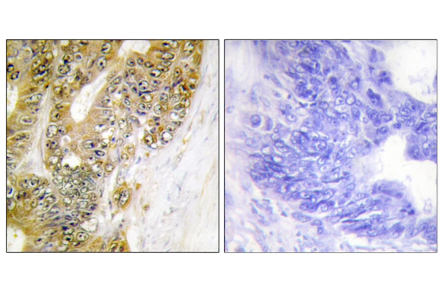 Immunohistochemistry - Anti-MDM2 Antibody (B1154) - Antibodies.com