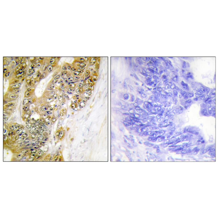 Immunohistochemistry - Anti-MDM2 Antibody (B1154) - Antibodies.com