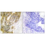 Immunohistochemistry - Anti-MDM2 Antibody (B1154) - Antibodies.com
