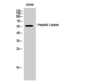 Western Blot - Anti-LIPC Antibody (C16099) - Antibodies.com