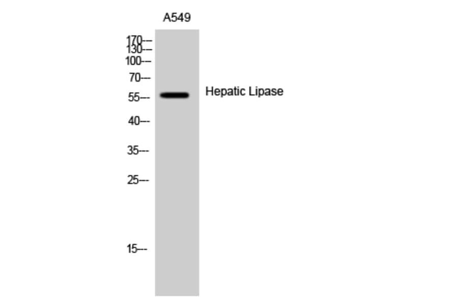 Western Blot - Anti-LIPC Antibody (C16099) - Antibodies.com
