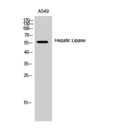 Western Blot - Anti-LIPC Antibody (C16099) - Antibodies.com
