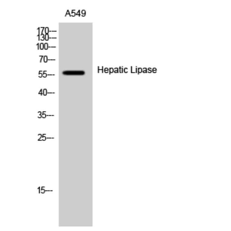 Western Blot - Anti-LIPC Antibody (C16099) - Antibodies.com