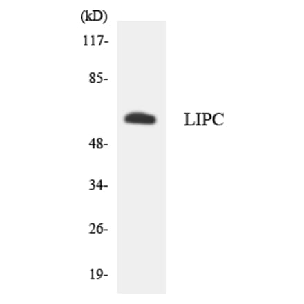 Western Blot - Anti-LIPC Antibody (R12-2970) - Antibodies.com