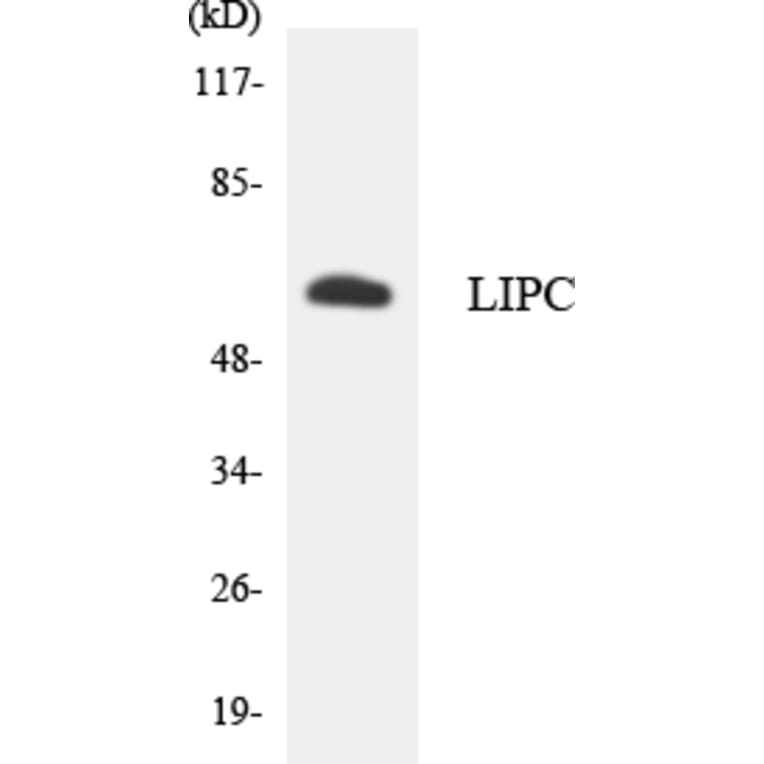 Western Blot - Anti-LIPC Antibody (R12-2970) - Antibodies.com