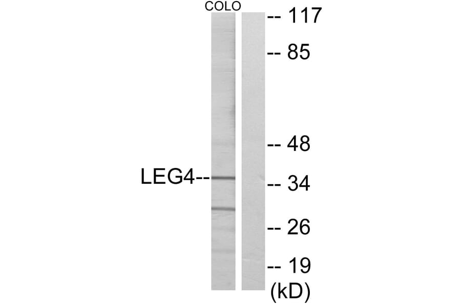 Western Blot - Anti-LEG4 Antibody (C13077) - Antibodies.com