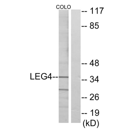 Western Blot - Anti-LEG4 Antibody (C13077) - Antibodies.com