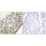 Immunohistochemistry - Anti-LATH Antibody (C11293) - Antibodies.com