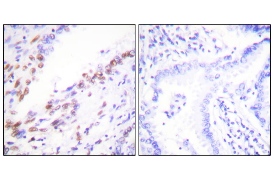 Immunohistochemistry - Anti-Ki67 Antibody (C0250) - Antibodies.com