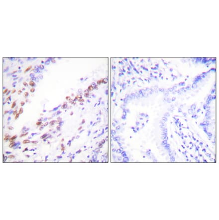 Immunohistochemistry - Anti-Ki67 Antibody (C0250) - Antibodies.com