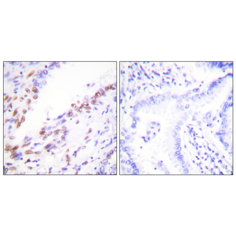 Immunohistochemistry - Anti-Ki67 Antibody (C0250) - Antibodies.com