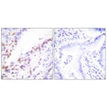 Immunohistochemistry - Anti-Ki67 Antibody (C0250) - Antibodies.com