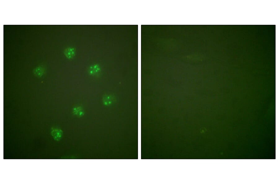 Immunofluorescence - Anti-Ki67 Antibody (C0250) - Antibodies.com