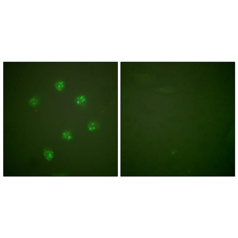 Immunofluorescence - Anti-Ki67 Antibody (C0250) - Antibodies.com