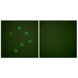 Immunofluorescence - Anti-Ki67 Antibody (C0250) - Antibodies.com