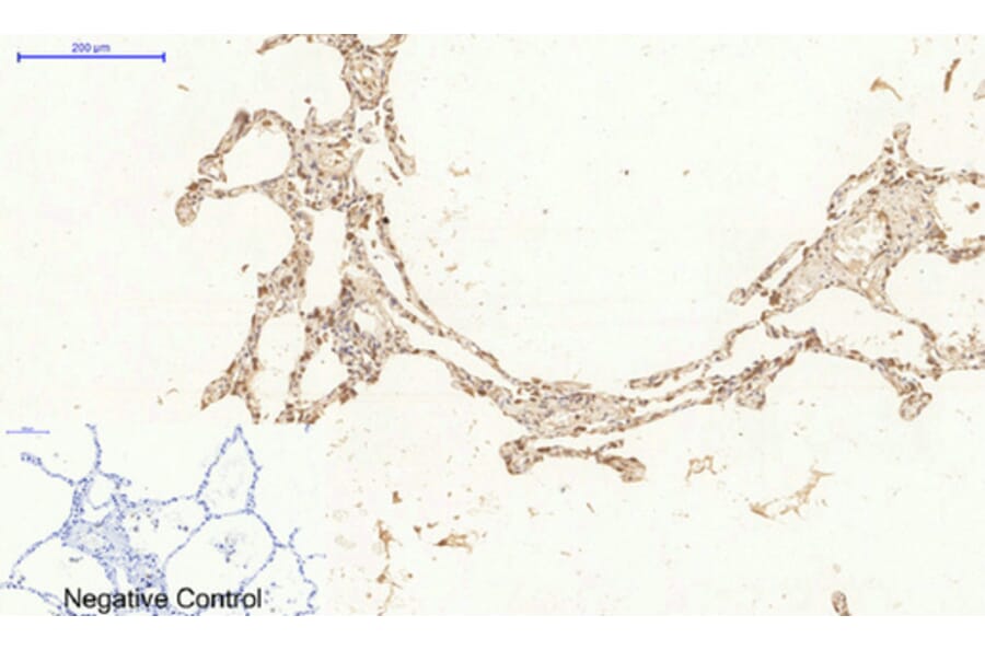 Immunohistochemistry - Anti-Ki67 Antibody (C0250) - Antibodies.com