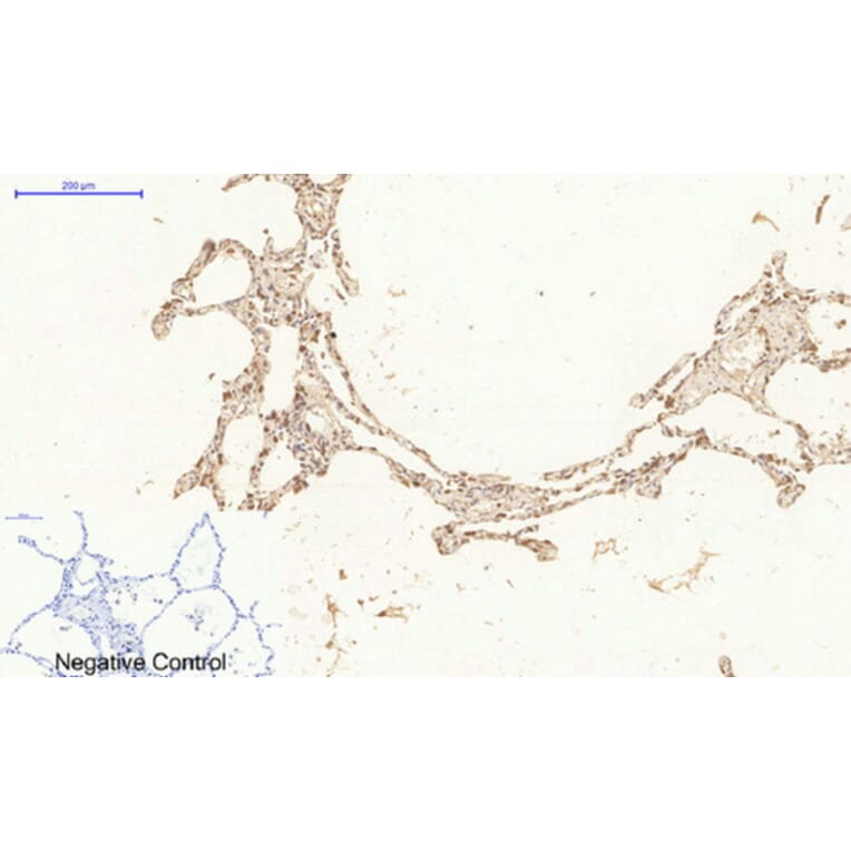 Immunohistochemistry - Anti-Ki67 Antibody (C0250) - Antibodies.com