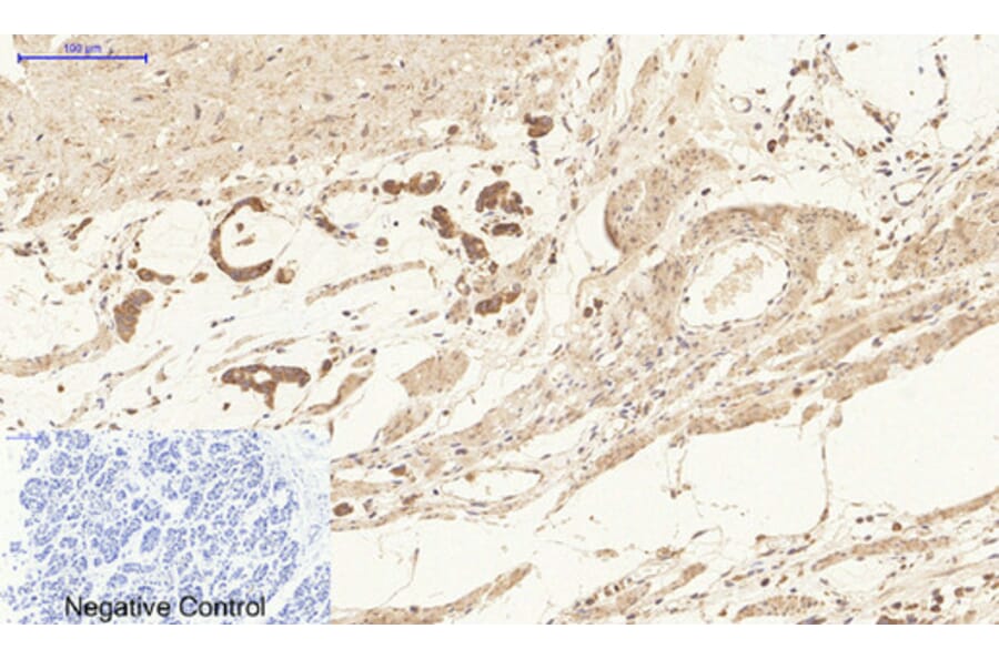 Immunohistochemistry - Anti-Ki67 Antibody (C0250) - Antibodies.com