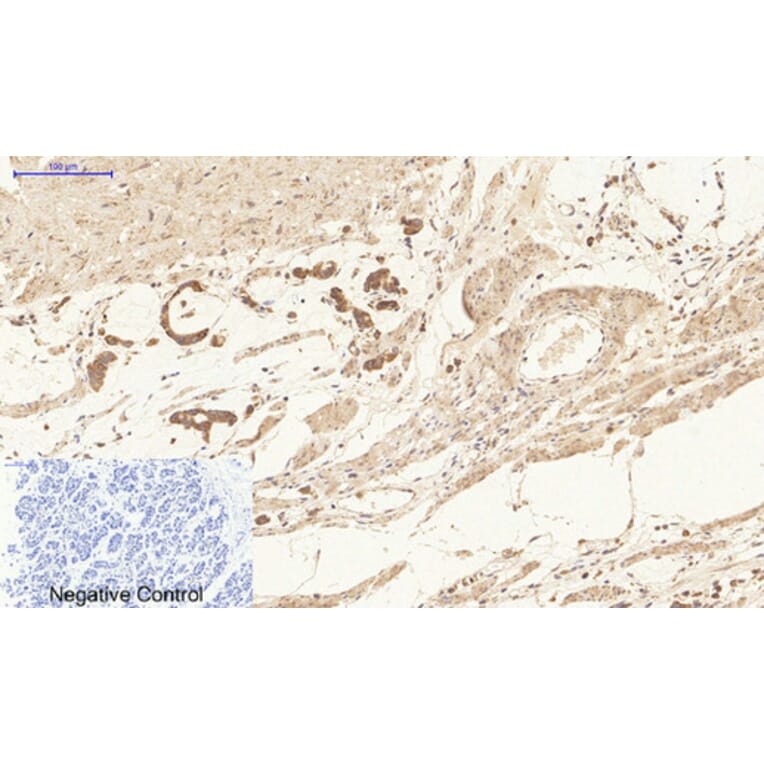 Immunohistochemistry - Anti-Ki67 Antibody (C0250) - Antibodies.com